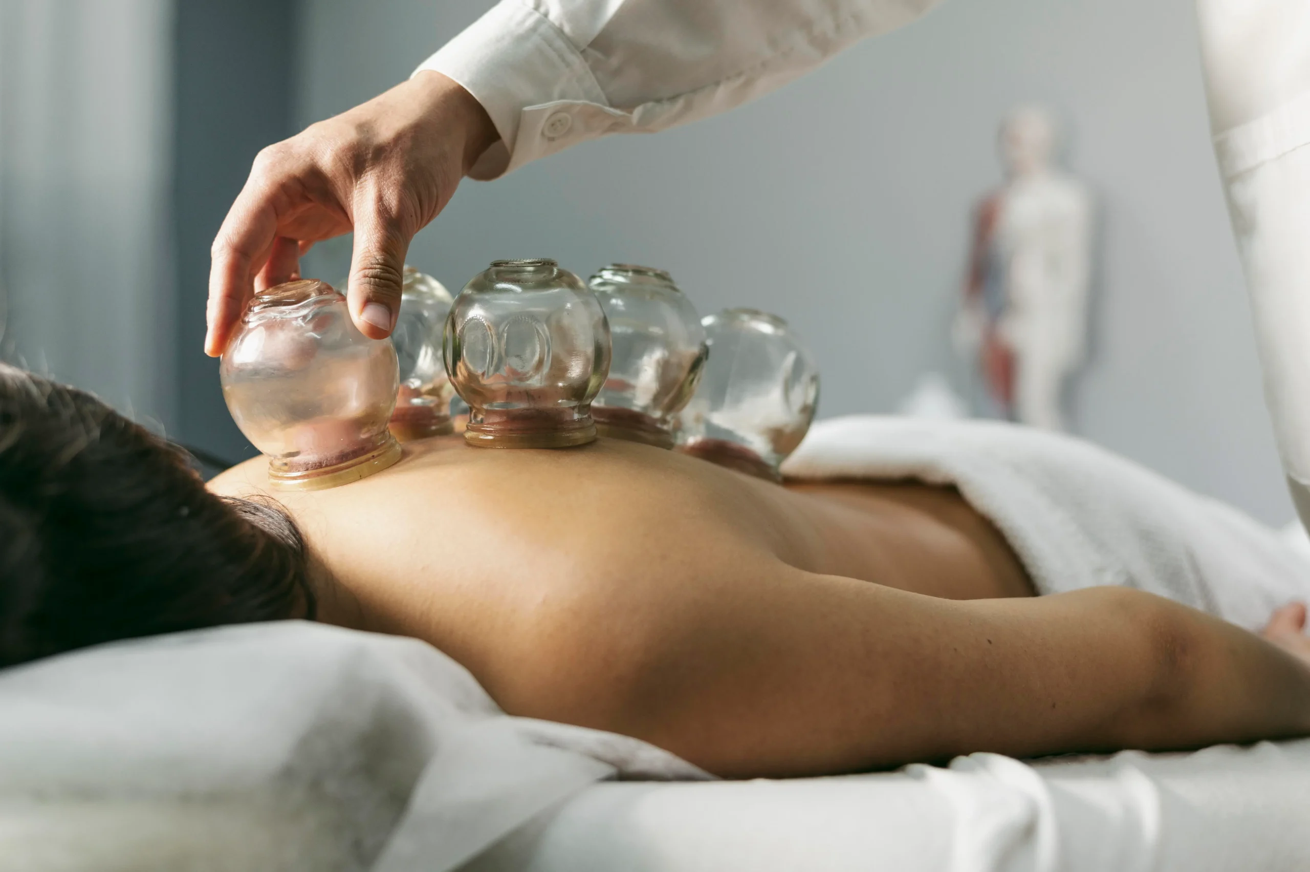 8-treatment package – $155; therapist performing cupping therapy using glass cups on a client’s back in a wellness clinic.
